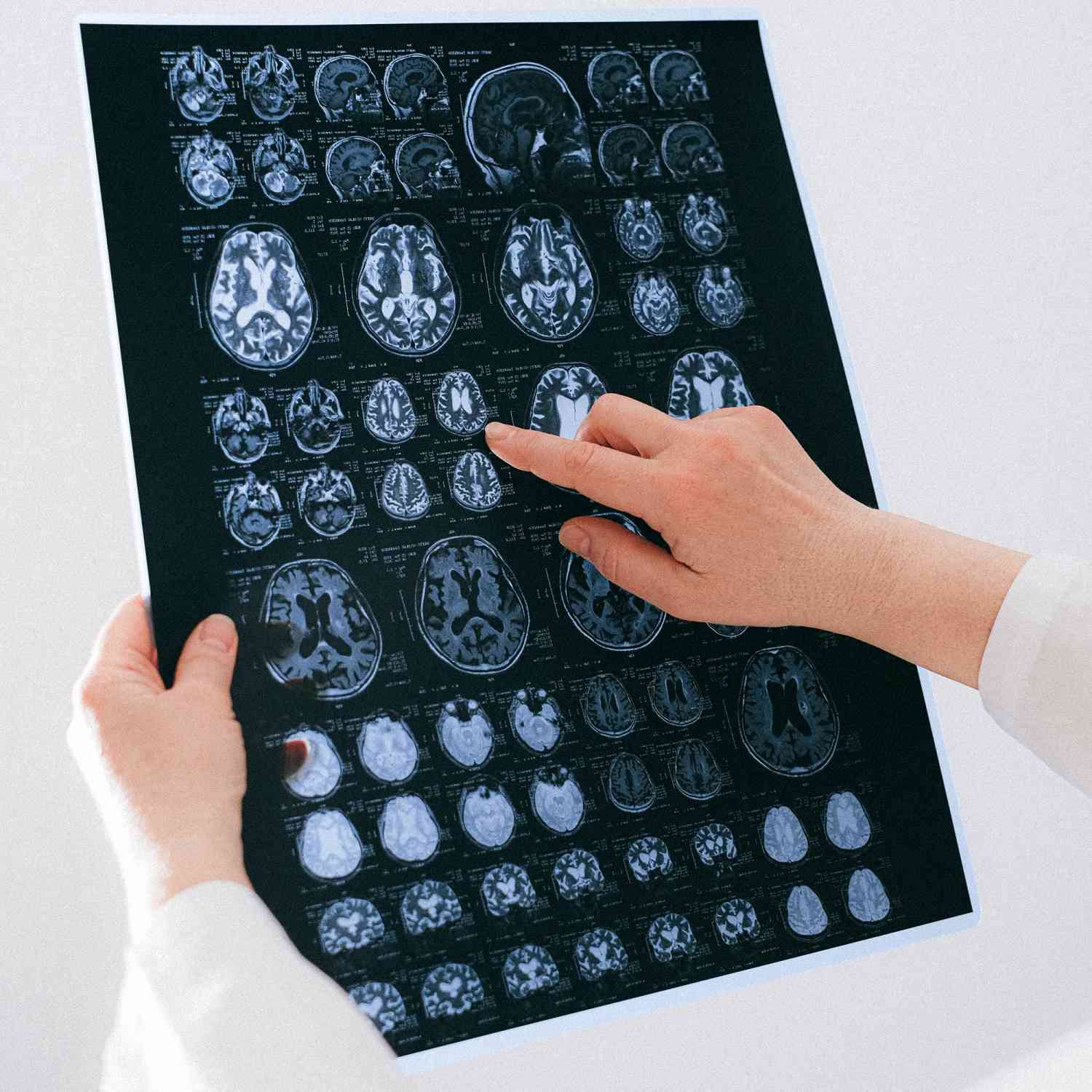 Neuroimagem (1) - Copia